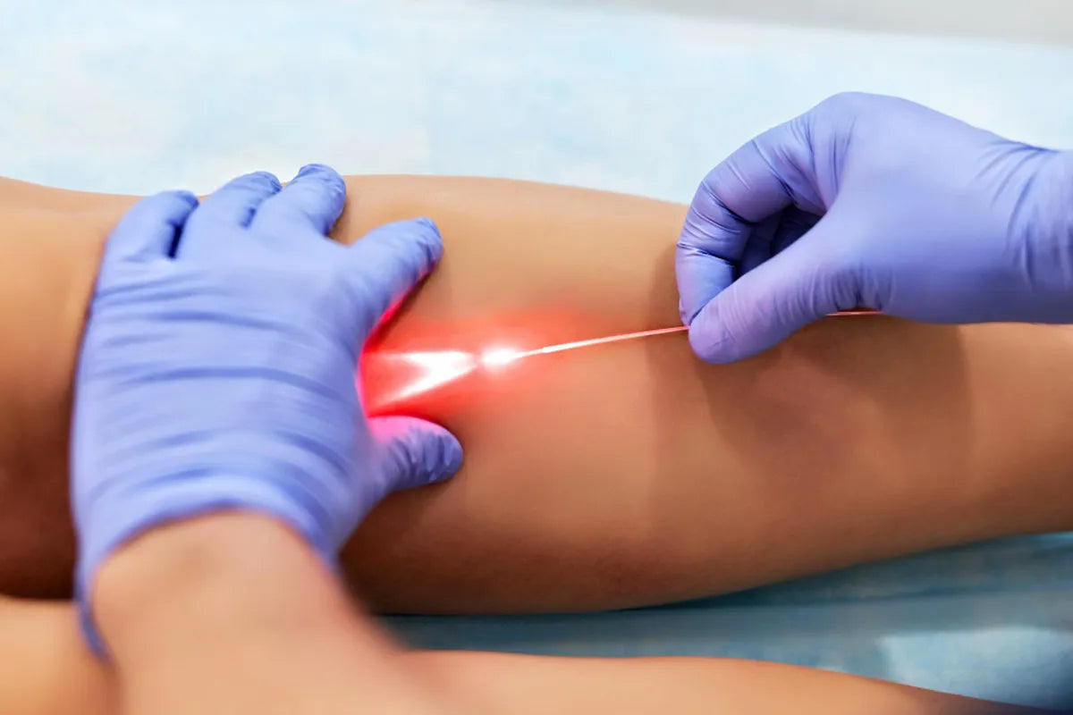 Endolaser piernas y lipoaspiración