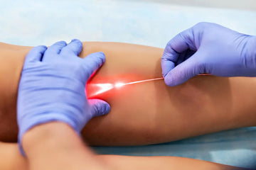 Endolaser piernas y lipoaspiración