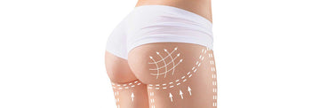Gluteoplastia con prótesis