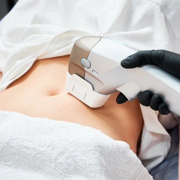 HIFU Corporal 1 zona