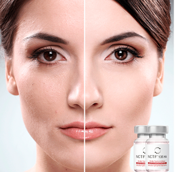 NCTF 135 (1 Sesión)