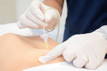 10 Sesiones de Carboxiterapia