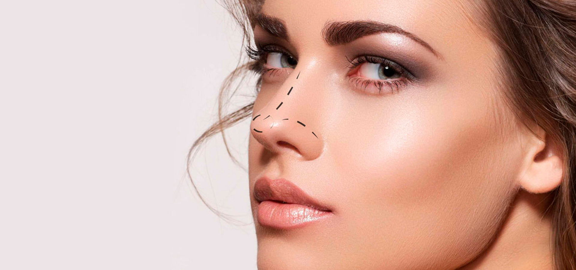Rinoplastia Estética