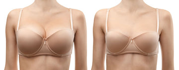 Mamoplastia de reducción